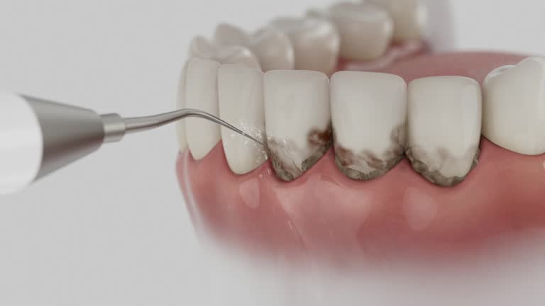 Trusted Teeth Cleaning And Checkup service in Longbranch, WA - Dentist Open Now